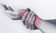 Những triệu chứng viêm khớp phụ nữ nên biết