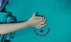 BVĐK Đức Giang: Cắt ngón tay thừa, tạo hình chuyển gân cho trẻ 5 tuổi