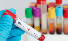 Khởi động Dự án Quỹ Toàn cầu phòng, chống HIV/AIDS giai đoạn 2018-2020