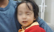 Rét đậm khắc nghiệt, nhiều trẻ liệt mặt, méo miệng vì nhiễm lạnh đột ngột