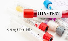 Bộ Y tế dự thảo Thông tư quy định trách nhiệm, trình tự thông báo kết quả xét nghiệm HIV dương tính