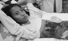 Kỳ diệu cô gái 23 lần phẫu thuật phức tạp vẫn thi đỗ Đại học Y Hà Nội