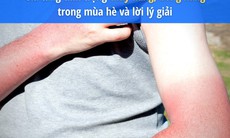 Gia tăng tình trạng cháy nắng, bỏng nắng trong mùa hè và lời lý giải từ bác sĩ