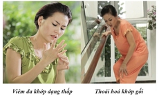 Bài thuốc Xương Khớp bí truyền kỳ diệu khắc tinh thoái hóa khớp,	 viêm, đau, cứng xương khớp