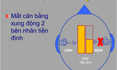 Lựa chọn thuốc trong điều trị chóng mặt