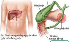 Những nguyên nhân gây vàng da