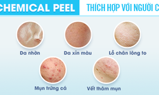 Ứng dụng Chemical peel trong kiềm nhờn - trị mụn, giảm thâm mụn và làm sáng da