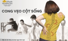 4 lý do không nên chủ quan với cong vẹo cột sống