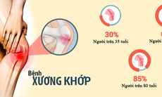 Dứt bệnh xương khớp đơn giản, hiệu quả từ thảo dược thiên nhiên