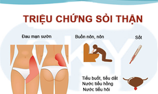 Sỏi thận và biện pháp ngăn ngừa sỏi từ thảo dược