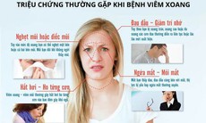 Tuyệt chiêu đẩy lùi viêm xoang nhờ ứng dụng kinh nghiệm của Hải Thượng Lãn Ông