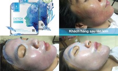 “Cứu cánh” hiệu quả cho làn da sau mỗi liệu trình spa lăn kim, phi kim hay nặn mụn đau rát