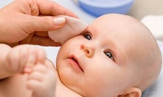 Có nên dung nước muối sinh lý vệ sinh mắt hàng ngày cho trẻ?