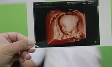 Ngắm trọn thế giới của con trong bụng mẹ với máy siêu âm 5D công nghệ 4.0