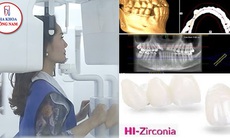 Trồng răng sứ với công nghệ CT 3D Conebeam và HI-Zirconia