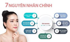 Dành cho những bạn nữ trẻ: Đừng mất cảnh giác với tàn nhang