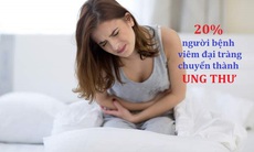 Khoảng 5 người mắc viêm đại tràng sẽ có 1 người chuyển biến thành ung thư