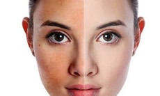 Da căng mịn mềm mượt cho chồng thêm "say đắm"