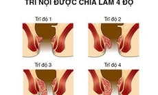 Bệnh trĩ nội độ 2 có nguy hiểm không?