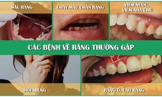 Người mắc bệnh răng miệng nên tái khám thời gian nào?