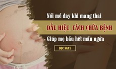 Nổi mề đay khi mang thai: Dấu hiệu, cách chữa bệnh giúp mẹ bầu hết mẩn ngứa