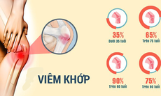 Cơ chế gây sưng, viêm khớp và giải pháp mới