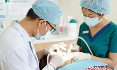 2 yếu tố góp phần giảm đau khi trồng răng Implant