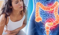 “Bảo bối” thiết yếu mùa COVID-19 cho người bị đại tràng