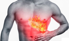 Hóa giải chứng “nóng gan”