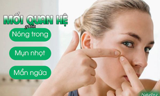 Mối liên hệ giữa nóng gan và mụn nhọt, nóng trong