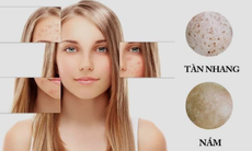 Collagen thuỷ phân – Xu hướng làm đẹp mới