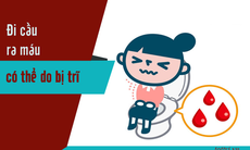Giảm nhanh chảy máu trong bệnh trĩ