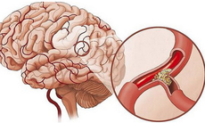 Giúp tăng cường tuần hoàn não, cải thiện trí nhớ ở người trung niên và cao  tuổi.