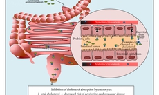 Lactobacillus plantarum hỗ trợ giảm mỡ máu, giảm nguy cơ xơ vữa động mạch