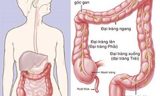 Hiểu biết về bệnh hội chứng ruột kích thích và điều trị bằng phương pháp đông y