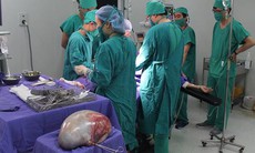 Đau tức vùng hạ vị 4 tháng, khi vào viện bác sĩ phẫu thuật lấy ra khối u gần 7kg