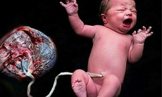 Bộ Y tế yêu cầu xác minh thông tin 2 mẹ con tử vong vì sinh con "thuận tự nhiên" tại nhà