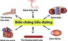 Cứ 10 bệnh nhân thì gần 6 người bị biến chứng do đái tháo đường