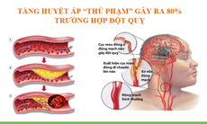 Xu hướng mới trong xử lý đẩy lùi tăng huyết áp và phòng ngừa đột quỵ