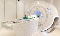 Đột quỵ não và vai trò của chụp cộng hưởng từ (MRI) trong tầm soát đột quỵ