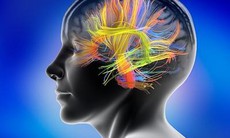 Dư thừa sắt trong não ảnh hưởng tới bệnh Parkinson