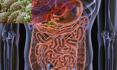 3 khám phá bất ngờ giữa vi khuẩn đường ruột và sức khỏe của bạn