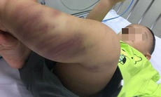 Vụ bỏ rơi bé 1 tuổi bị đánh tổn thương não: Công an "giăng lưới" 5 đối tượng tại bệnh viện