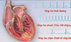 Không nên quá lo lắng về bất lợi của thuốc