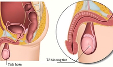 Những điều chưa biết về tinh hoàn