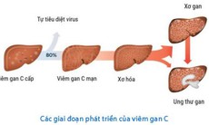 Mở rộng thuốc trị viêm gan C của người lớn cho trẻ em