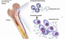 FDA chấp thuận điều trị mới cho đa u tủy