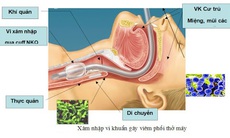 Thuốc mới trị viêm phổi mắc phải ở bệnh viện