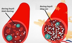 Kích hoạt đường huyết cao làm tăng nguy cơ tử vong ở bệnh nhân COVID-19