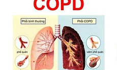 Thuốc hít  giúp điều trị duy trì COPD